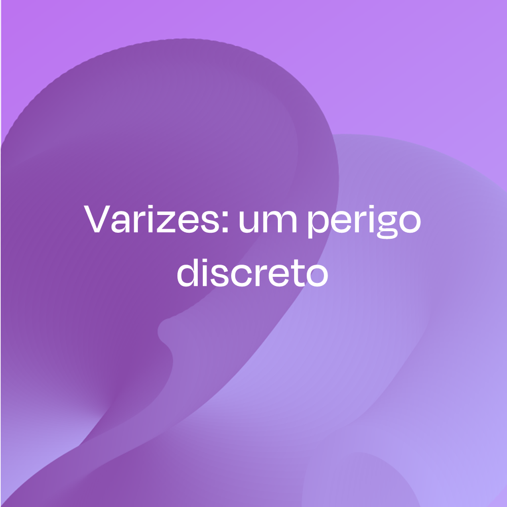Varizes: um perigo discreto
